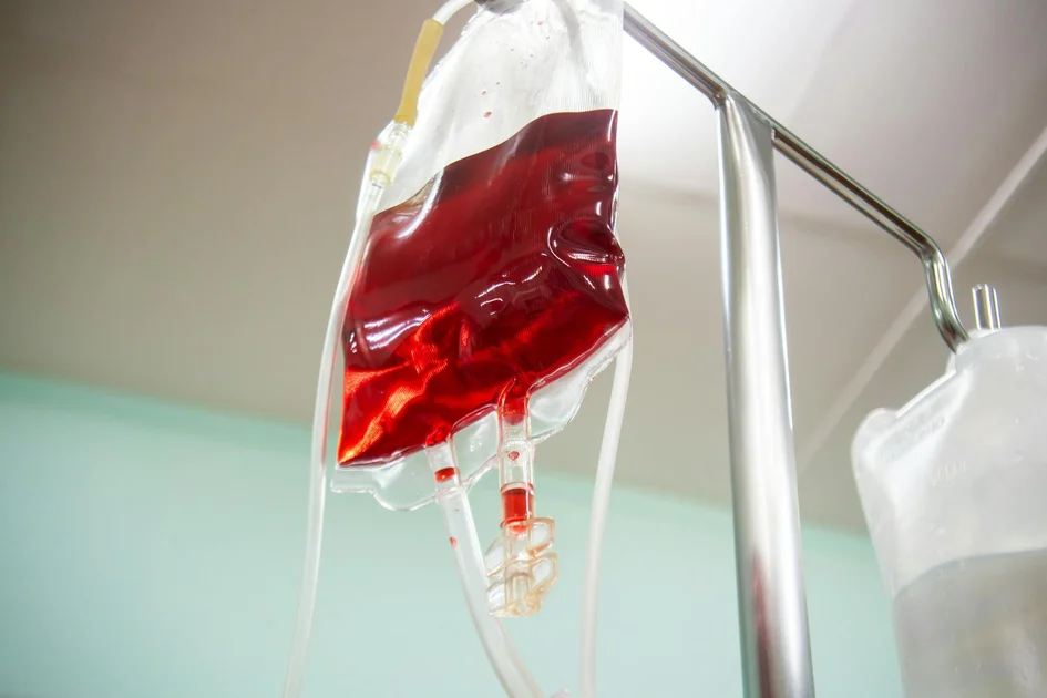 The Fallacy of Deferred Fluid Changes